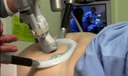 Le bras robotisé est placé sur le ventre du patient. Crédits : CNES.